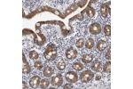 Immunohistochemical staining of human duodenum shows moderate cytoplasmic positivity in glandular cells.