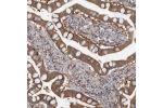 Immunohistochemical staining of human small intestine shows moderate to strong cytoplasmic positivity in glandular cells.