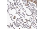 Immunohistochemical staining of human lung shows moderate cytoplasmic positivity in macrophages.