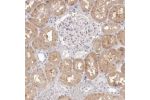 Immunohistochemical staining of human kidney shows weak cytoplasmic positivity in cells in tubules.