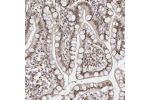 Immunohistochemical staining of human small intestine shows strong nuclear positivity in glandular cells.