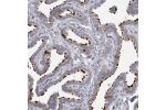 Immunohistochemical staining of human fallopian tube shows strong positivity in cilia, as well as moderate cytoplasmic staining in glandular cells.