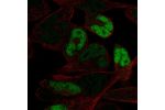 Immunofluorescent staining of human cell line RH-30 shows localization to nucleoplasm.