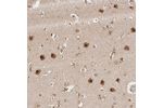 Immunohistochemical staining of human cerebral cortex shows strong cytoplasmic and nuclear positivity in neuronal cells.