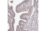 Immunohistochemical staining of human fallopian tube shows moderate cytoplasmic positivity in glandular cells.