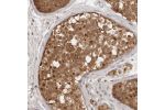 Immunohistochemical staining of human testis shows distinct nuclear and cytoplasmic positivity in seminiferous duct cells.