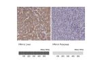 Immunohistochemistry analysis in human liver and pancreas tissues using HPA028407 antibody. Corresponding PAH RNA-seq data are presented for the same tissues.