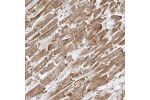 Immunohistochemical staining of human heart muscle shows moderate membranous and cytoplasmic positivity in myocytes.