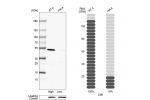 Western blot analysis in human cell line RT-4 and human cell line HeLa.