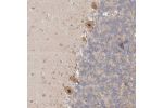 Immunohistochemical staining of human cerebellum shows moderate nuclear and cytoplasmic positivity in purkinje cells.