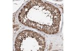 Immunohistochemical staining of human testis shows strong cytoplasmic positivity in cells in seminiferous ducts.