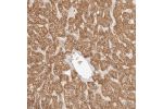 Immunohistochemical staining of human liver shows moderate cytoplasmic positivity with a granular pattern in hepatocytes.