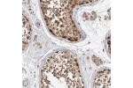 Immunohistochemical staining of human testis shows moderate to strong nuclear and cytoplasmic positivity in cells in seminiferous ducts.