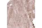 Immunohistochemical staining of human liver shows strong cytoplasmic positivity in hepatocytes.