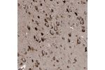 Immunohistochemical staining of human cerebral cortex shows strong cytoplasmic positivity in neurons.