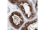 Immunohistochemical staining of human Testis shows strong nuclear and cytoplasmic positivity in cells in seminiferous ducts.