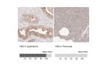 Immunohistochemistry analysis in human epididymis and pancreas tissues using HPA028587 antibody. Corresponding HK2 RNA-seq data are presented for the same tissues.