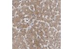 Immunohistochemical staining of human esophagus shows strong cytoplasmic and nuclear positivity in squamous epithelial cells.