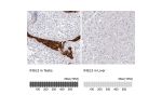 Immunohistochemistry analysis in human testis and liver tissues using HPA028615 antibody. Corresponding INSL3 RNA-seq data are presented for the same tissues.