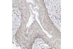 Immunohistochemical staining of human Skin shows moderate cytoplasmic positivity in squamous epithelial cells.