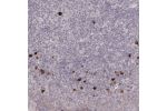 Immunohistochemical staining of human tonsil shows strong cytoplasmic positivity in non-germinal center cells.
