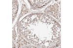 Immunohistochemical staining of human testis shows moderate nuclear positivity in Leydig cells.