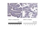 Immunohistochemistry analysis in human fallopian tube and prostate tissues using HPA028666 antibody. Corresponding SPAG17 RNA-seq data are presented for the same tissues.