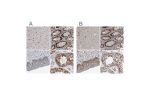 Immunohistochemical staining of human cerebral cortex, lower gastrointestinal, skin and testis using Anti-CHD1L antibody HPA028670 (A) shows similar protein distribution across tissues to independent antibody HPA027789 (B).