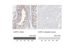 Immunohistochemistry analysis in human testis and skeletal muscle tissues using HPA028674 antibody. Corresponding ESPN RNA-seq data are presented for the same tissues.