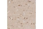 Immunohistochemical staining of human Cerebral cortex shows moderate nuclear positivity in neuronal cells.