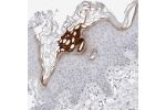 Immunohistochemical staining of human skin shows keratinocyte positivity in epidermal cells.