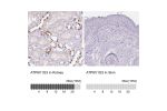 Immunohistochemistry analysis in human kidney and skin tissues using HPA028701 antibody. Corresponding ATP6V1G3 RNA-seq data are presented for the same tissues.