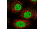 Immunofluorescent staining of human cell line MCF7 shows localization to nucleoplasm & cell junctions.