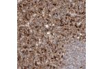 Immunohistochemical staining of human spleen shows strong cytoplasmic positivity in cells in red pulp.