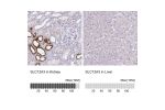 Immunohistochemistry analysis in human kidney and liver tissues using HPA028748 antibody. Corresponding SLC12A3 RNA-seq data are presented for the same tissues.