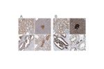 Immunohistochemical staining of human kidney, pancreas, prostate and testis using Anti-ACLY antibody HPA028758 (A) shows similar protein distribution across tissues to independent antibody HPA022434 (B).