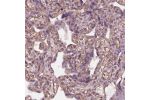 Immunohistochemistry analysis in human placenta and skeletal muscle tissues using Anti-HTR1B antibody. Corresponding HTR1B RNA-seq data are presented for the same tissues.