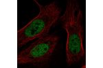 Immunofluorescent staining of human cell line U-2 OS shows localization to nucleoplasm.