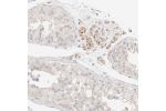 Immunohistochemical staining of human pancreas shows strong membranous and cytoplasmic positivity in islets of Langerhans.
