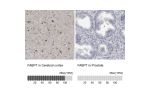 Immunohistochemistry analysis in human cerebral cortex and prostate tissues using HPA028825 antibody. Corresponding FABP7 RNA-seq data are presented for the same tissues.