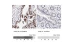 Immunohistochemistry analysis in human placenta and colon tissues using Anti-TFAP2A antibody. Corresponding TFAP2A RNA-seq data are presented for the same tissues.