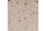 Immunohistochemical staining of human cerebral cortex shows strong cytoplasmic positivity in neuronal cells.
