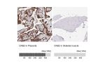 Immunohistochemistry analysis in human placenta and skeletal muscle tissues using HPA028888 antibody. Corresponding DAB2 RNA-seq data are presented for the same tissues.
