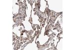 Immunohistochemical staining of human lung shows strong nuclear and cytoplasmic positivity in pneumocytes and macrophages.
