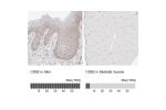 Immunohistochemistry analysis in human skin and skeletal muscle tissues using HPA028900 antibody. Corresponding CD82 RNA-seq data are presented for the same tissues.