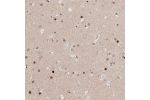 Immunohistochemical staining of human Cerebral cortex shows moderate nuclear positivity in glial and neuronal cells.