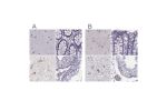Immunohistochemical staining of human cerebral cortex, colon, hypothalamus and testis using Anti-CALCR antibody HPA028962 (A) shows similar protein distribution across tissues to independent antibody HPA061428 (B).