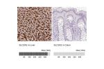 Immunohistochemistry analysis in human liver and colon tissues using Anti-SLC2A2 antibody. Corresponding SLC2A2 RNA-seq data are presented for the same tissues.