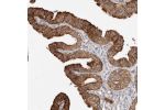 Immunohistochemical staining of human fallopian tube shows strong cytoplasmic positivity in glandular cells.
