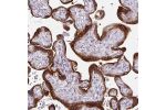 Immunohistochemical staining of human placenta shows strong cytoplasmic positivity in trophoblastic cells.